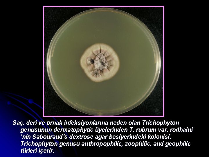 Saç, deri ve tırnak infeksiyonlarına neden olan Trichophyton genusunun dermatophytic üyelerinden T. rubrum var.