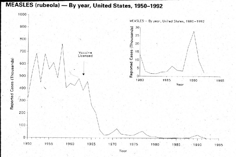 Measles - By year in the United States 