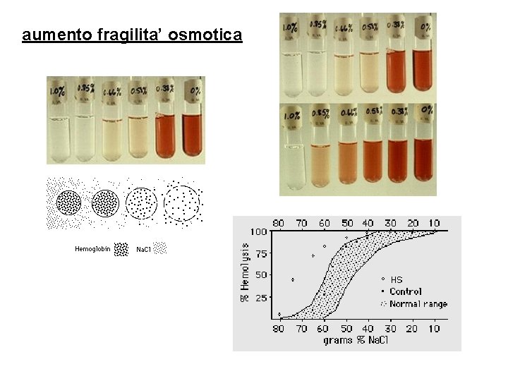 aumento fragilita’ osmotica 