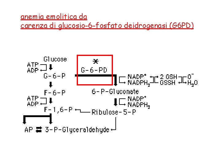 anemia emolitica da carenza di glucosio-6 -fosfato deidrogenasi (G 6 PD) 