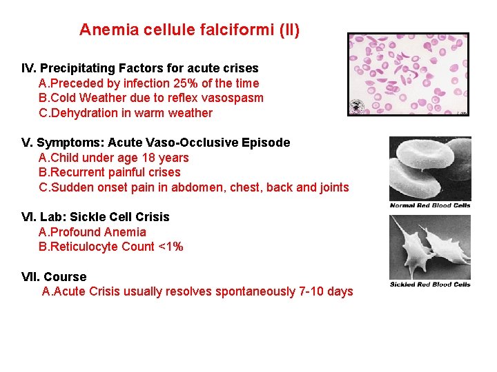 Anemia cellule falciformi (II) IV. Precipitating Factors for acute crises A. Preceded by infection