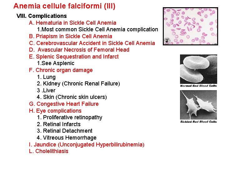 Anemia cellule falciformi (III) VIII. Complications A. Hematuria in Sickle Cell Anemia 1. Most