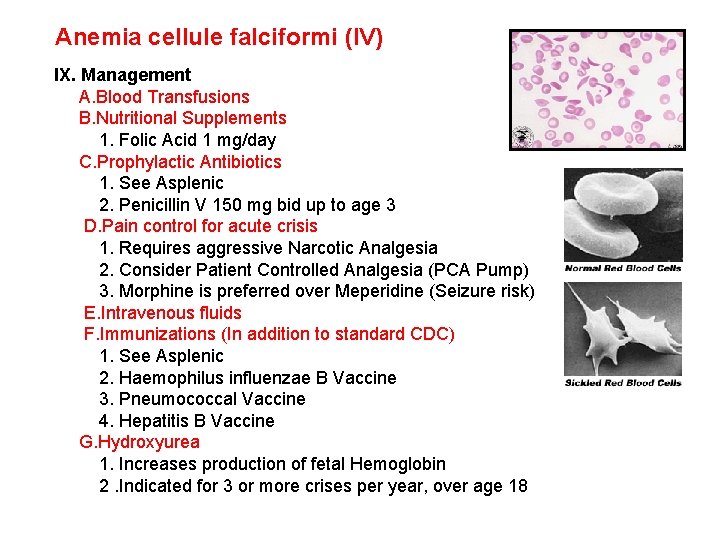 Anemia cellule falciformi (IV) IX. Management A. Blood Transfusions B. Nutritional Supplements 1. Folic