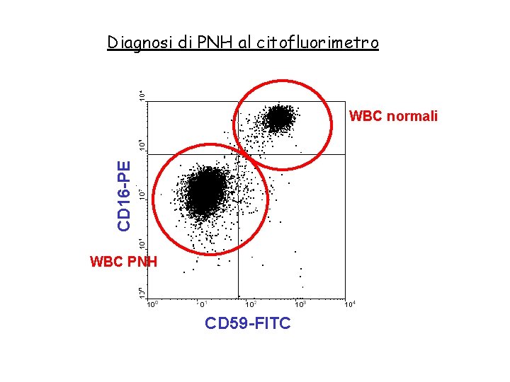 Diagnosi di PNH al citofluorimetro CD 16 -PE WBC normali WBC PNH CD 59