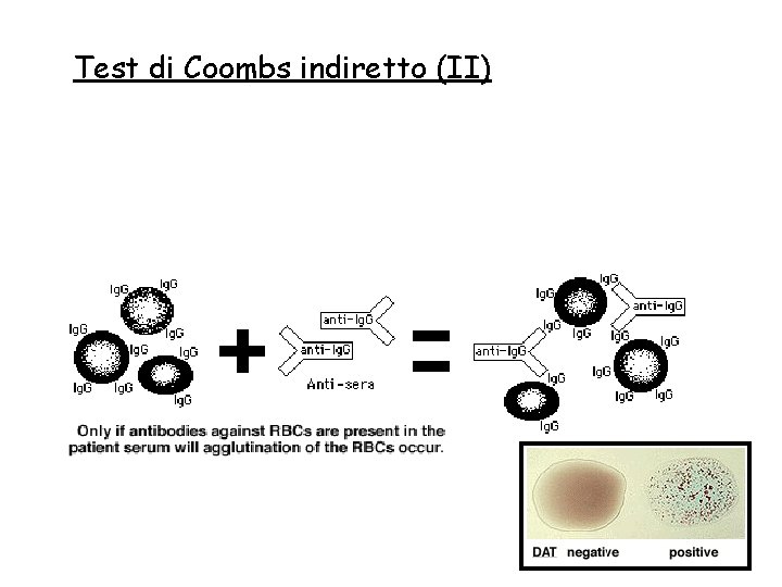 Test di Coombs indiretto (II) 