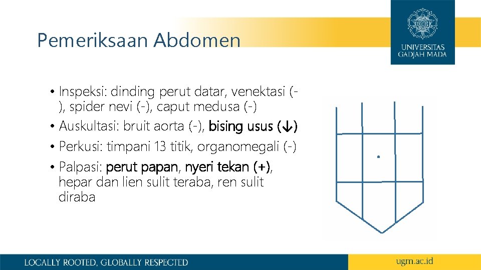 Pemeriksaan Abdomen • Inspeksi: dinding perut datar, venektasi (), spider nevi (-), caput medusa