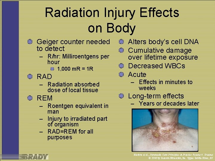 Radiation Injury Effects on Body Geiger counter needed to detect – R/hr: Milliroentgens per