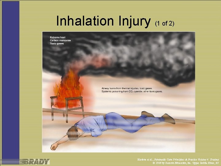 Inhalation Injury (1 of 2) Bledsoe et al. , Paramedic Care Principles & Practice