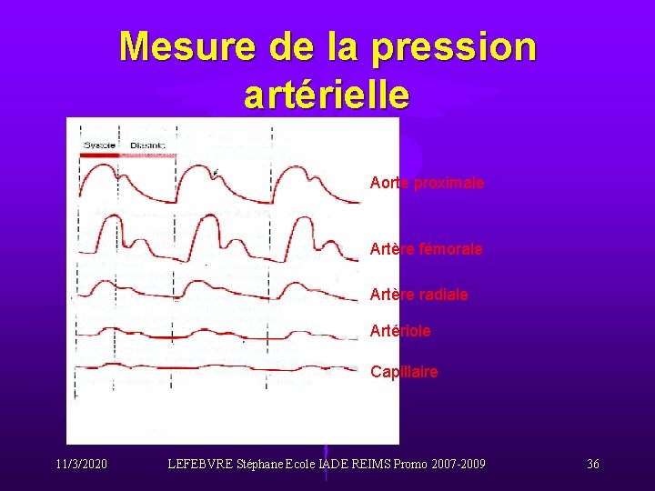 Mesure de la pression artérielle Aorte proximale Artère fémorale Artère radiale Artériole Capillaire 11/3/2020