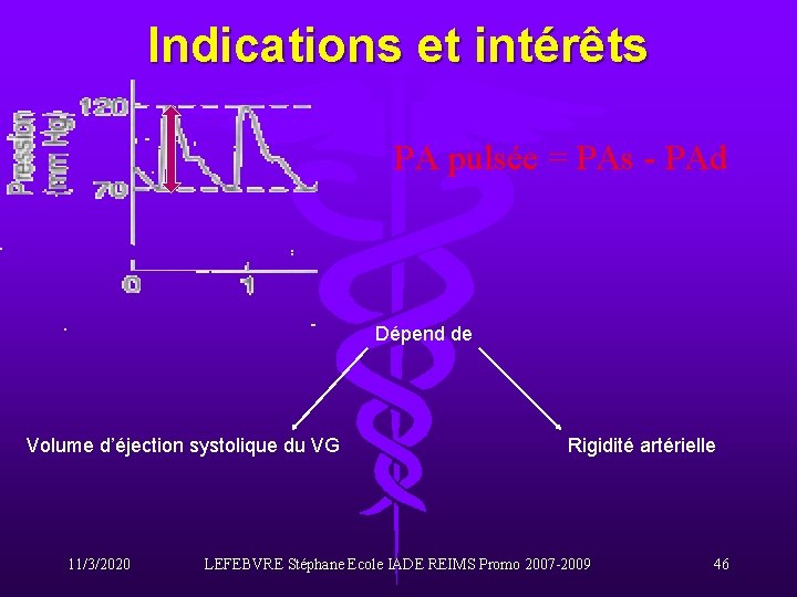 Indications et intérêts PA pulsée = PAs - PAd Dépend de Volume d’éjection systolique