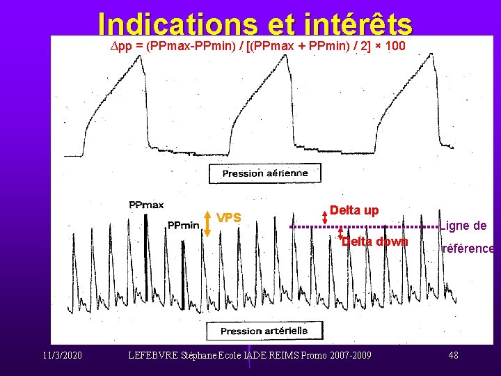 Indications et intérêts ∆pp = (PPmax-PPmin) / [(PPmax + PPmin) / 2] × 100