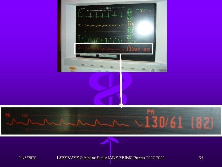 11/3/2020 LEFEBVRE Stéphane Ecole IADE REIMS Promo 2007 -2009 55 