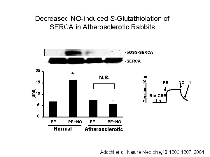 Decreased NO-induced S-Glutathiolation of SERCA in Atherosclerotic Rabbits -b. GSS-SERCA 20 * N. S.