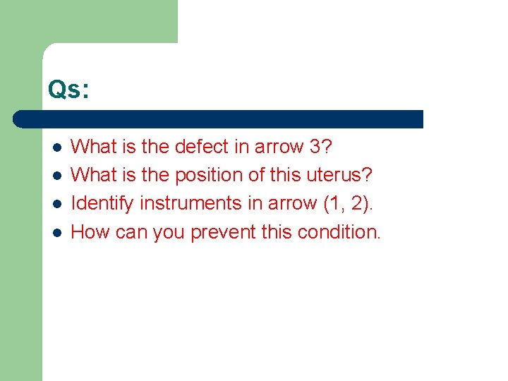 Qs: l l What is the defect in arrow 3? What is the position