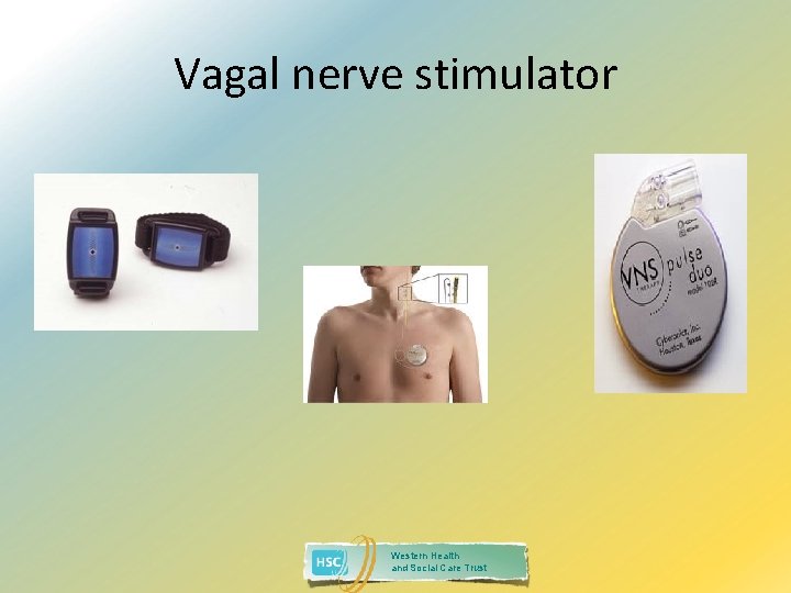 Vagal nerve stimulator Western Health and Social Care Trust 