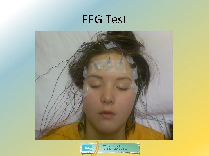 EEG Test Western Health and Social Care Trust 