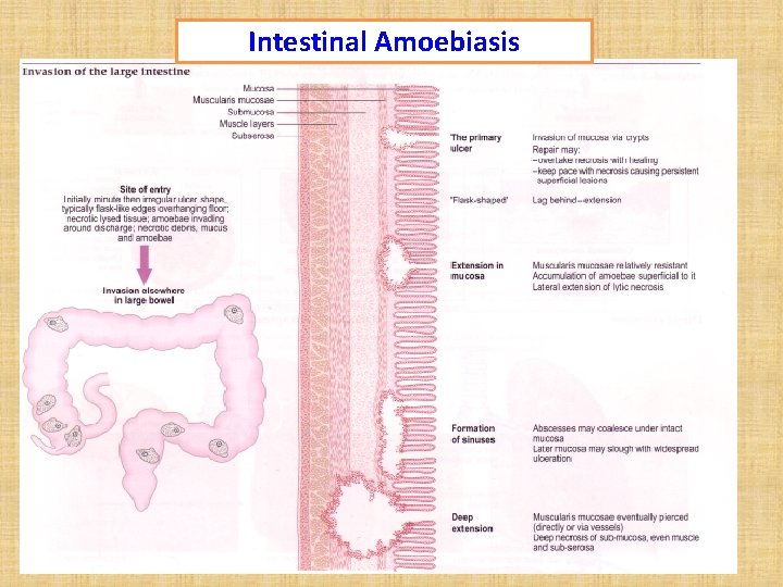 Intestinal Amoebiasis 21 