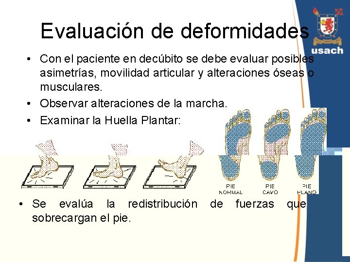 Evaluación de deformidades • Con el paciente en decúbito se debe evaluar posibles asimetrías, Evaluación de deformidades • Con el paciente en decúbito se debe evaluar posibles asimetrías,