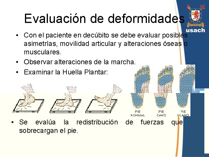 Evaluación de deformidades • Con el paciente en decúbito se debe evaluar posibles asimetrías,