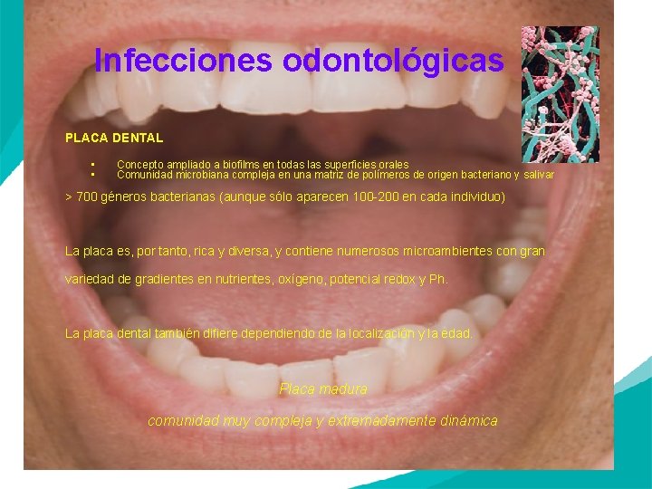 Infecciones odontológicas PLACA DENTAL • • Concepto ampliado a biofilms en todas las superficies