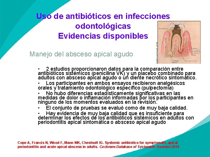 Uso de antibióticos en infecciones odontológicas Evidencias disponibles Manejo del absceso apical agudo •