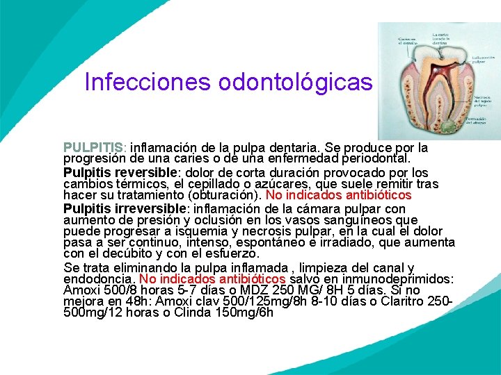 Infecciones odontológicas PULPITIS: inflamación de la pulpa dentaria. Se produce por la progresión de