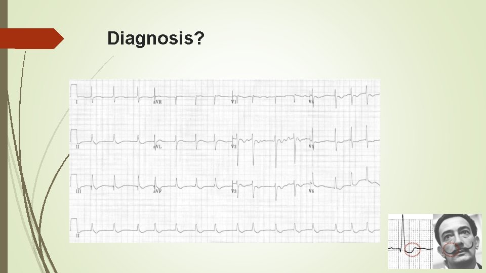 Diagnosis? 