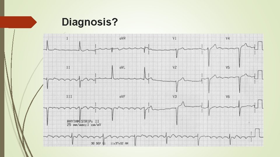 Diagnosis? 