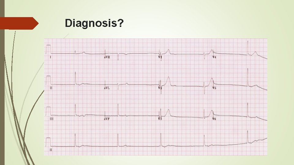 Diagnosis? 