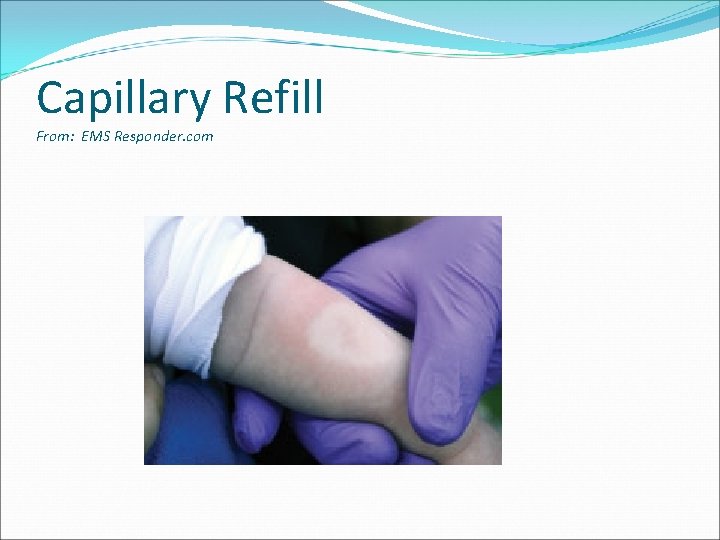 Capillary Refill From: EMS Responder. com 