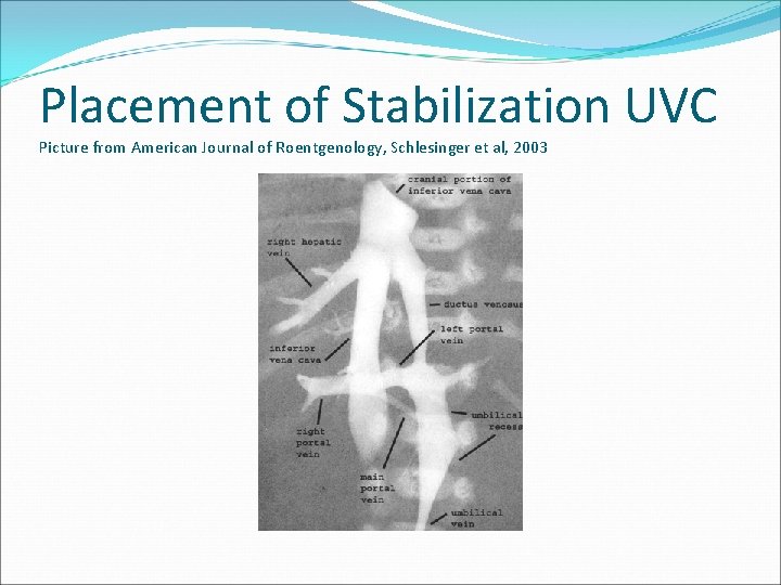 Placement of Stabilization UVC Picture from American Journal of Roentgenology, Schlesinger et al, 2003
