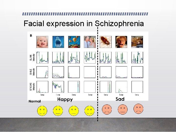 Facial expression in Schizophrenia 