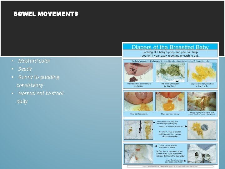 BOWEL MOVEMENTS • Mustard color • Seedy • Runny to pudding consistency • Normal