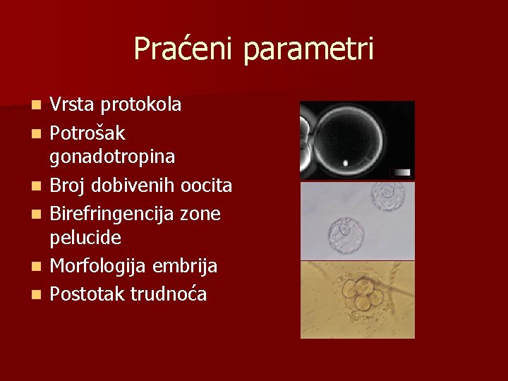 Praćeni parametri n n n Vrsta protokola Potrošak gonadotropina Broj dobivenih oocita Birefringencija zone