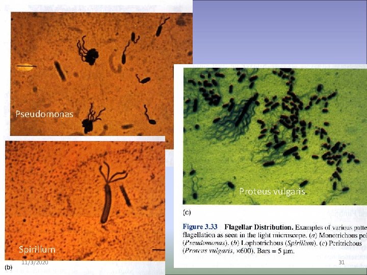 Pseudomonas Proteus vulgaris Spirillum 11/3/2020 31 