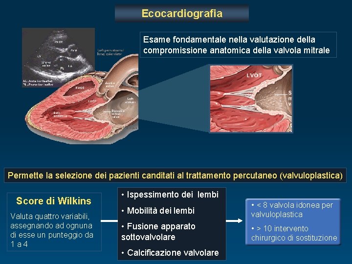 Ecocardiografia Esame fondamentale nella valutazione della compromissione anatomica della valvola mitrale Permette la selezione