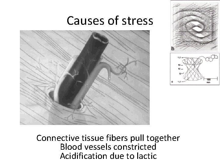 Causes of stress Connective tissue fibers pull together Blood vessels constricted Acidification due to