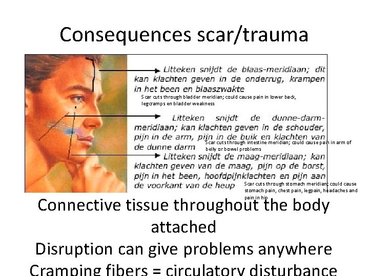 Consequences scar/trauma Scar cuts through bladder meridian; could cause pain in lower back, legcramps