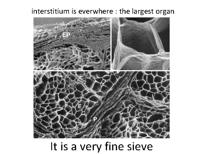 interstitium is everwhere : the largest organ It is a very fine sieve 