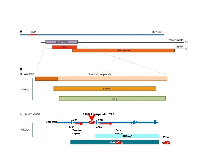 G 1896 A = stop codon, TAG Core gene ATG 1814 Precore region ATG