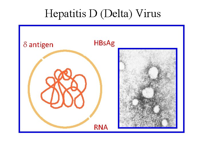 Hepatitis D (Delta) Virus d antigen HBs. Ag RNA 