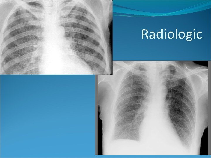 Radiologic 