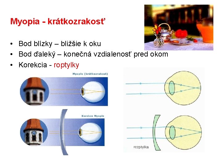Myopia - krátkozrakosť • Bod blízky – bližšie k oku • Bod ďaleký –