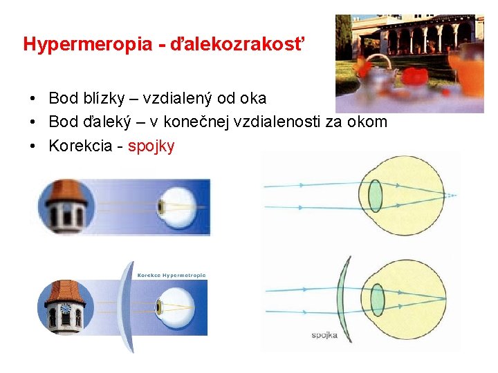 Hypermeropia - ďalekozrakosť • Bod blízky – vzdialený od oka • Bod ďaleký –