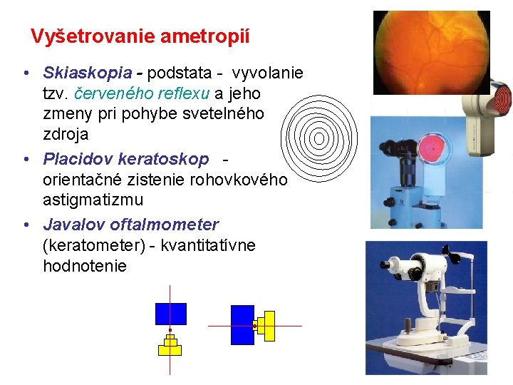 Vyšetrovanie ametropií • Skiaskopia - podstata - vyvolanie tzv. červeného reflexu a jeho zmeny