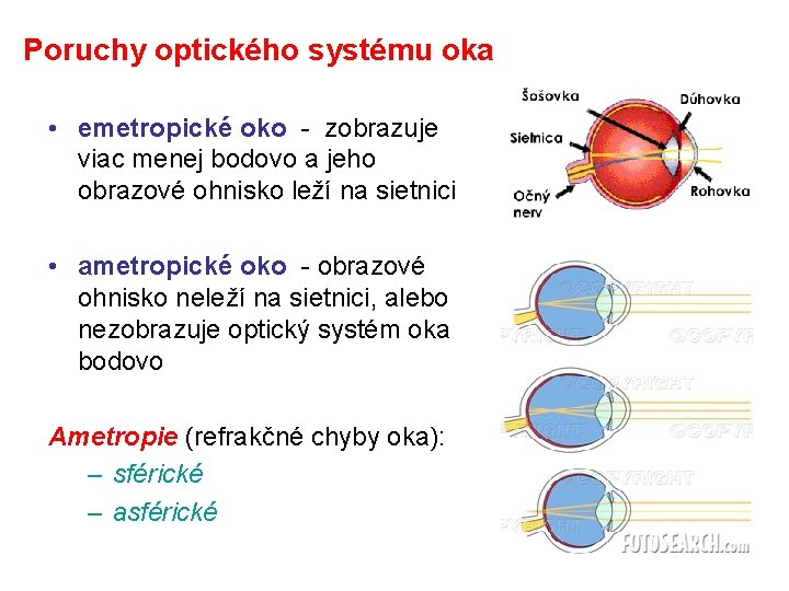 Poruchy optického systému oka • emetropické oko - zobrazuje viac menej bodovo a jeho