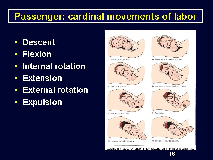 Passenger: cardinal movements of labor • • • Descent Flexion Internal rotation Extension External