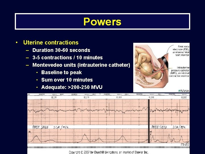 Powers • Uterine contractions – Duration 30 -60 seconds – 3 -5 contractions /