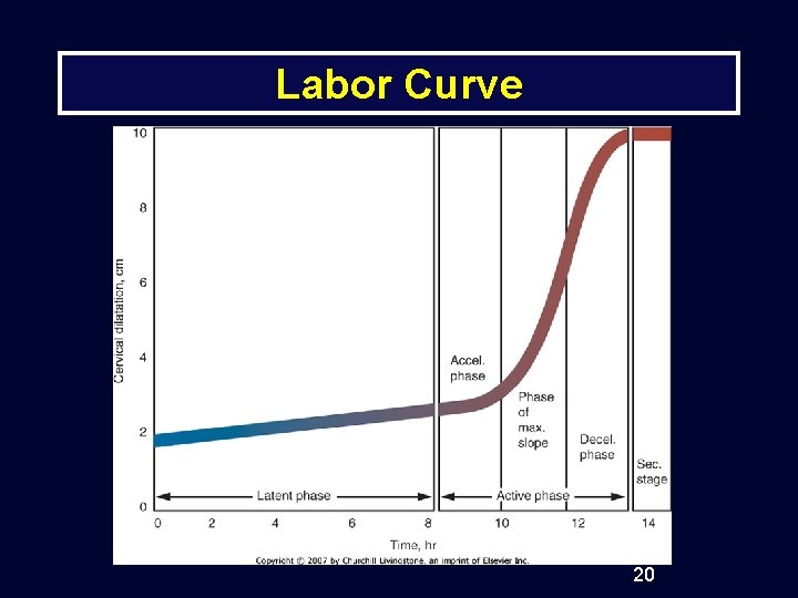 Labor Curve 20 