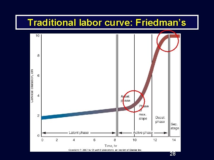 Traditional labor curve: Friedman’s 28 